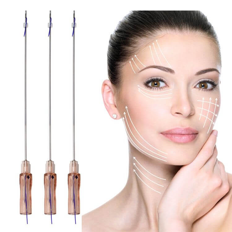 Botox PDO Threadlift 0