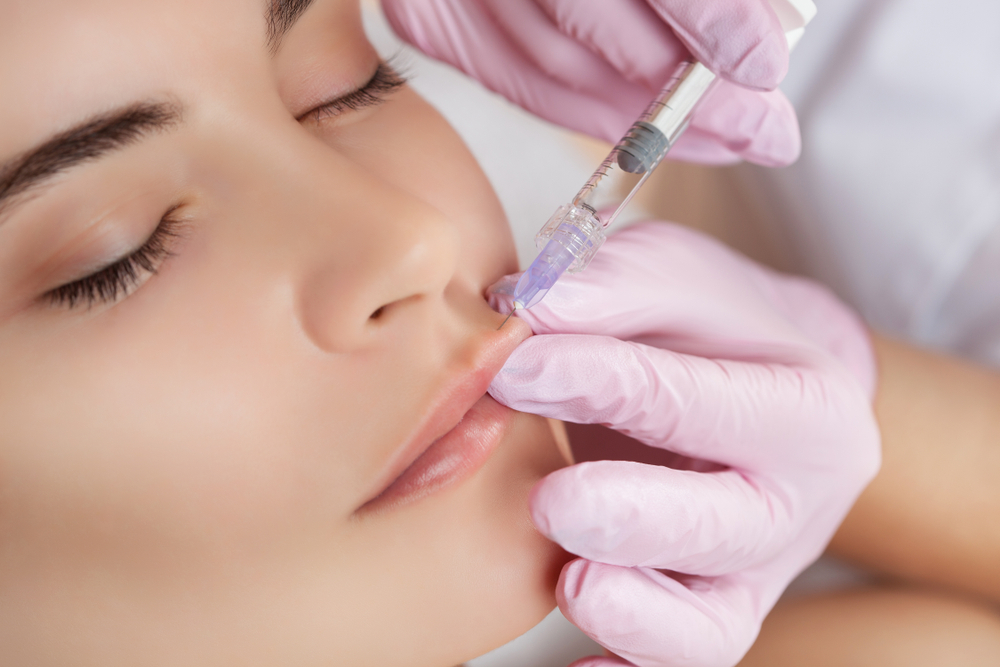 Dermal Fillers image