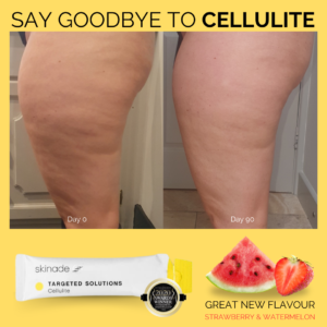 skinade cellulite drinks 90 day supply